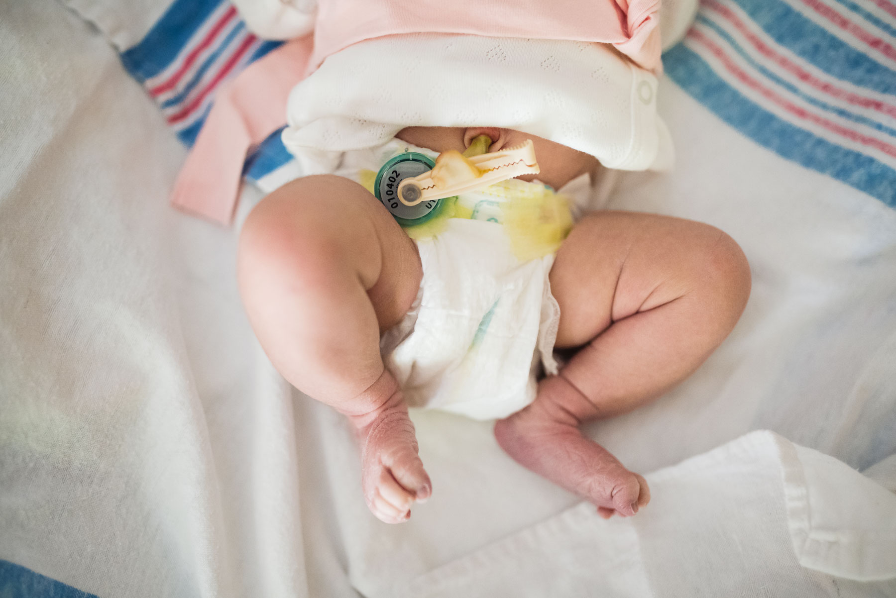 newborn baby legs and umbilical cord